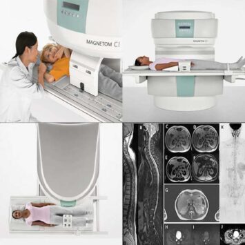 Best Open Mri Scan In Chennai Madras Scans Labs