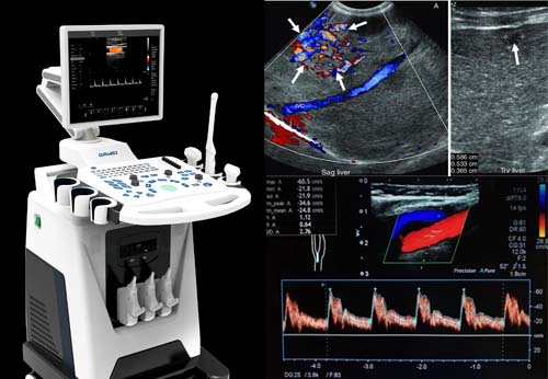 Best Colour Doppler ultrasound in Chennai