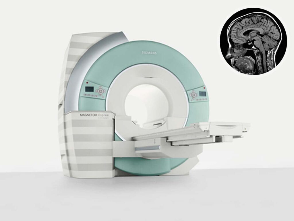 Best Mri Scan in chennai