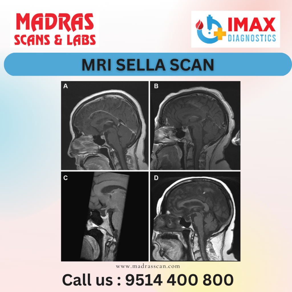 MRi Sella Scan