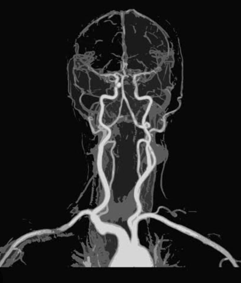 Mr Angiogram In Chennai - Madras Scans & Labs