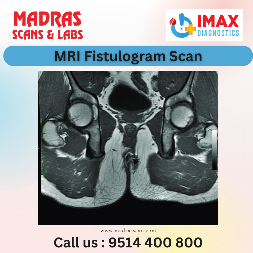 mri fistulogram scan