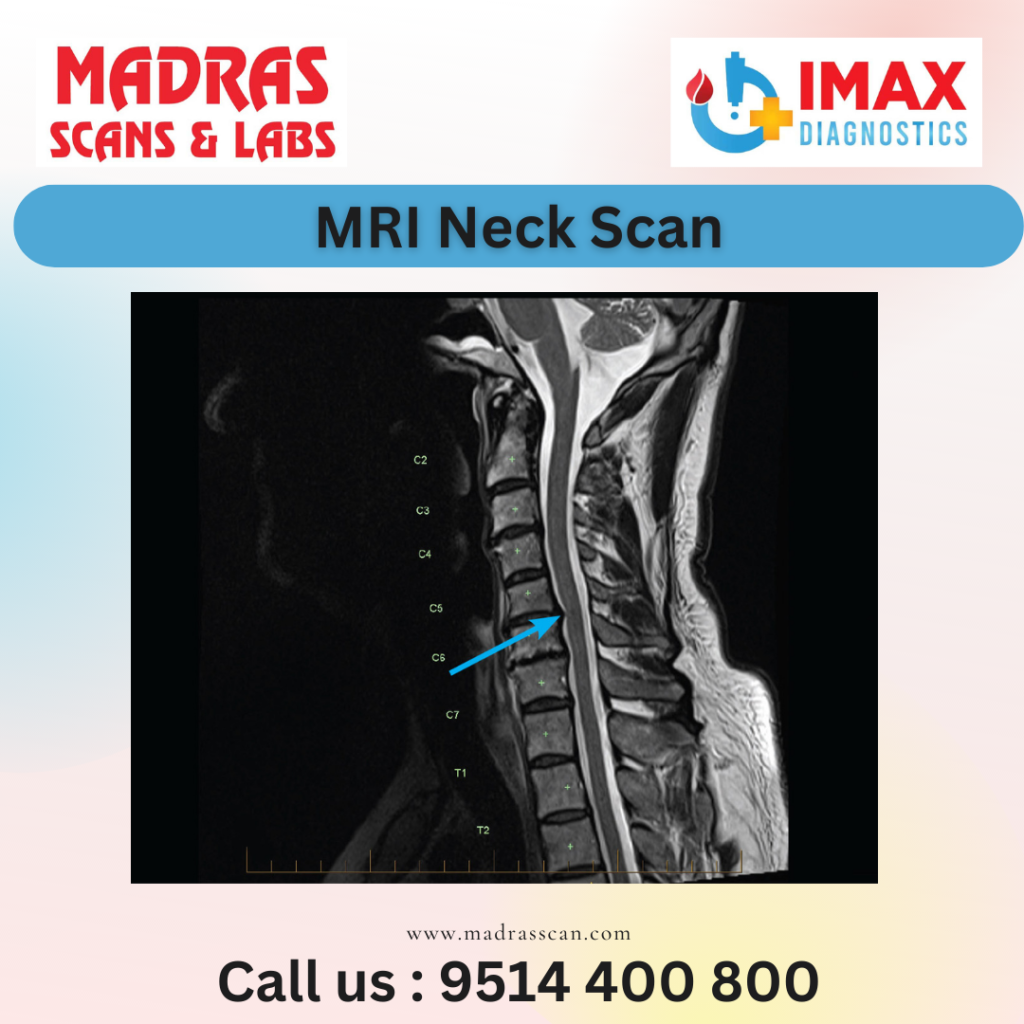 MRI Necj Scan In Chennai