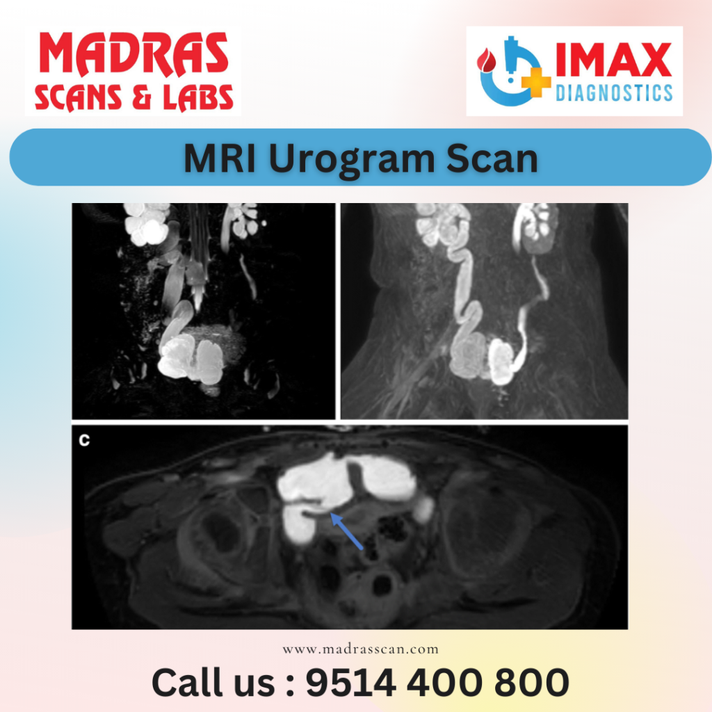 mri urogram scan in chennai