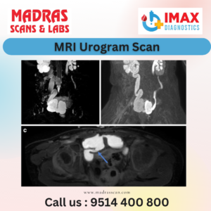 Mri Urogram Scan In Chennai - Madras Scans