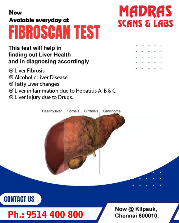 Liver Fibroscan in chennai