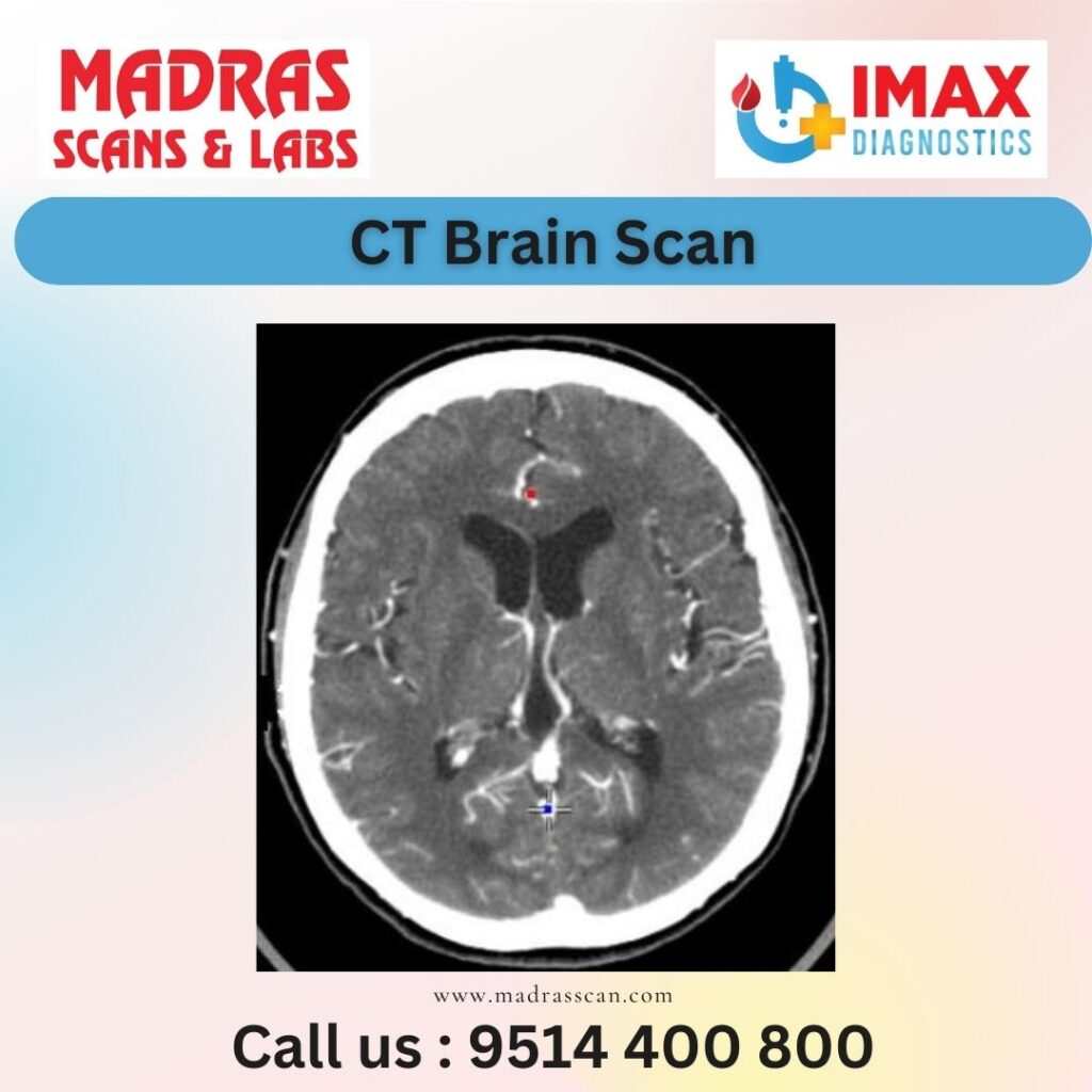 Low cost CT Brain Scan