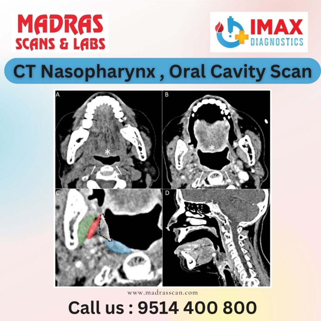 CT SCan in Chennai