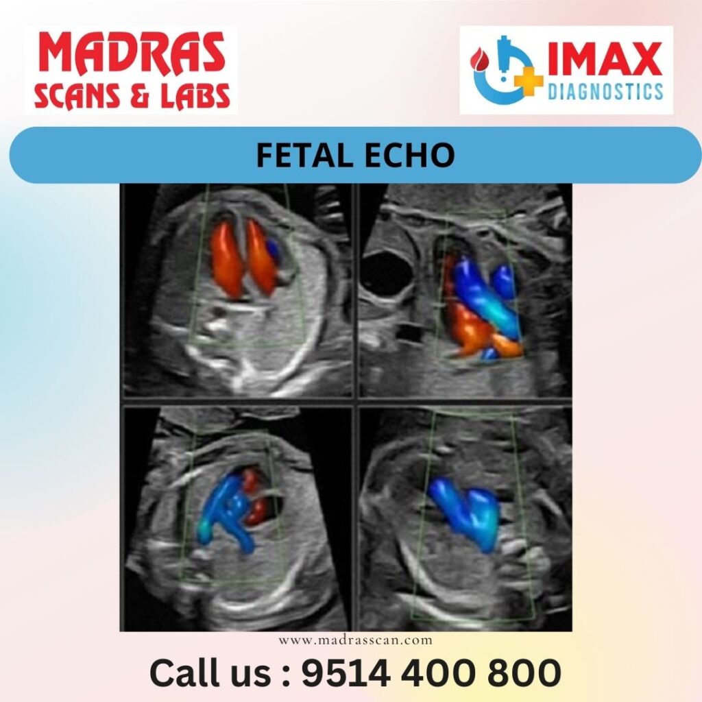 Fetal Echo Scan in Chennai