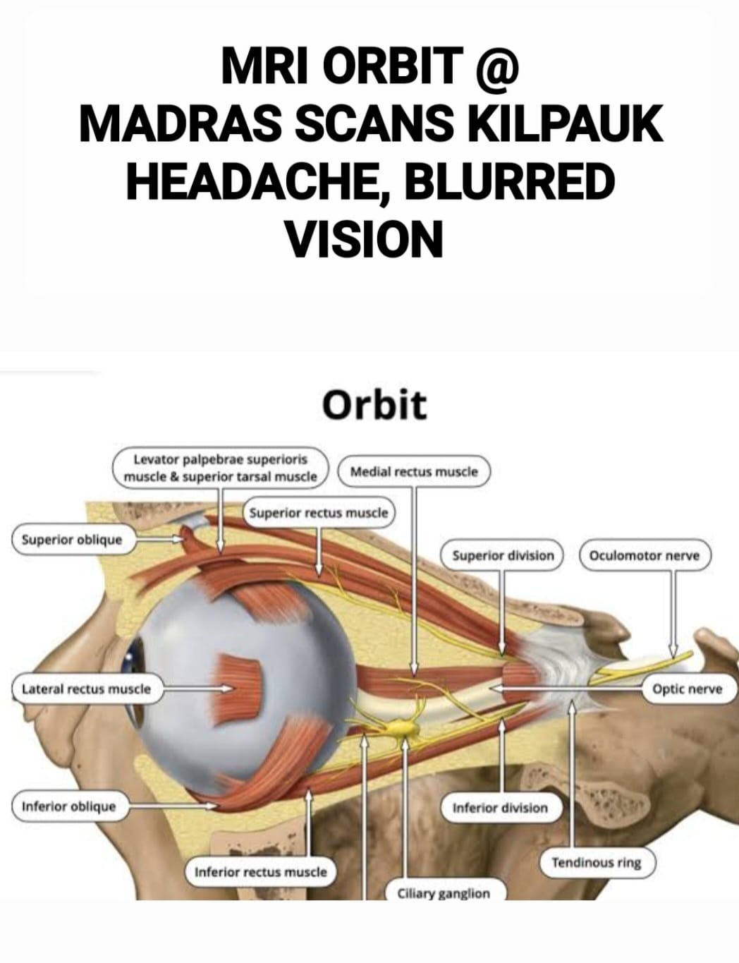 Orbits Mri Master MRI Orbit Scan In Chennai - Madras Scans